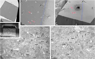 Neuron Class and Target Variability in the Three-Dimensional Localization of SK2 Channels in Hippocampal Neurons as Detected by Immunogold FIB-SEM